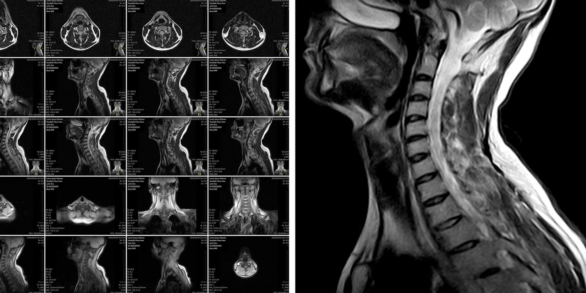 Radiografía de columna lumbar, 2 posiciones en Hospital San José