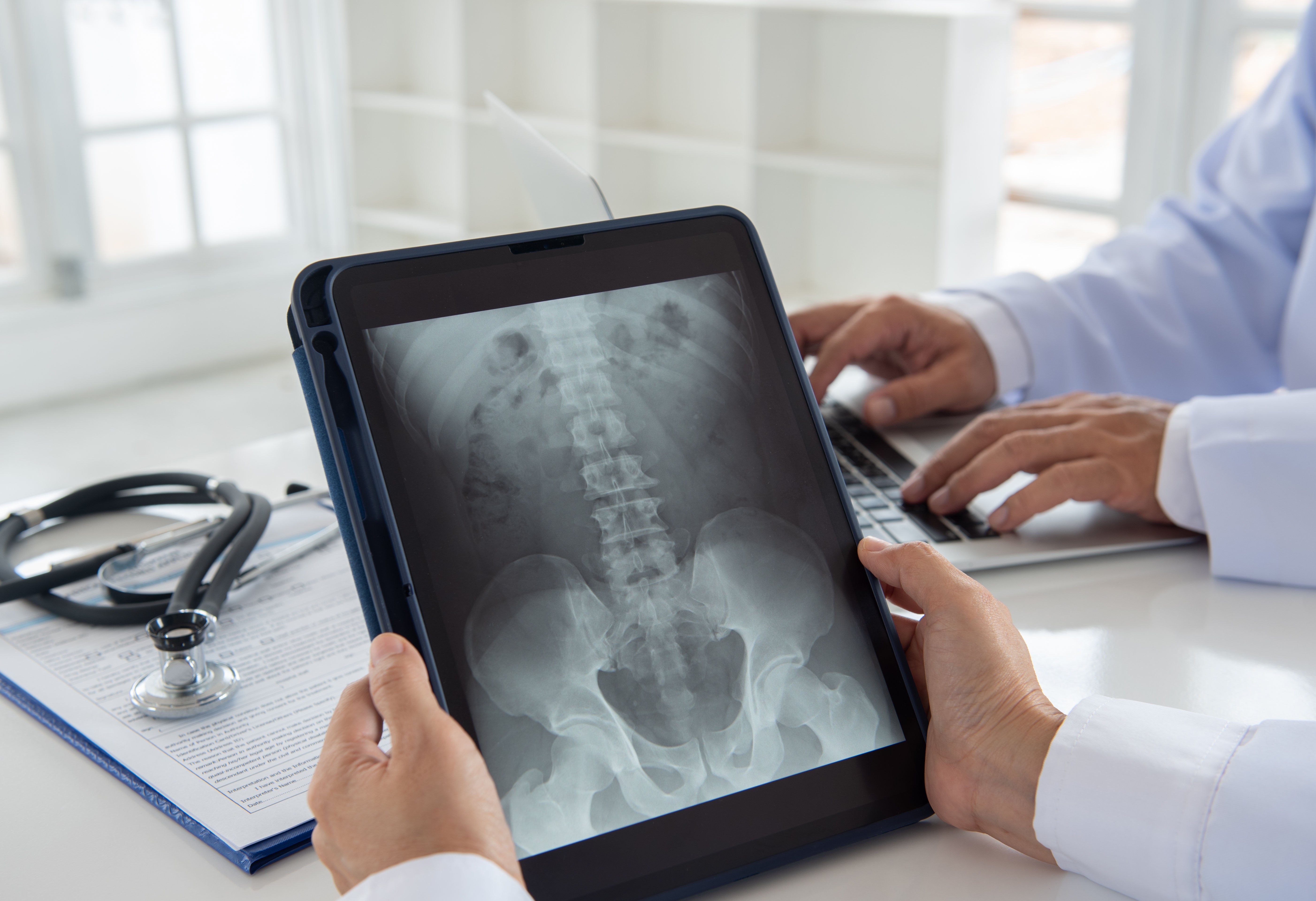 Radiografía de columna lumbar, 2 posiciones en Hospital San José