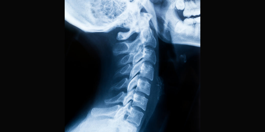 Radiografía de columna cervical, 2 posiciones en Hospital San José