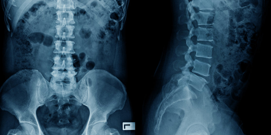 Radiografía de columna lumbar, 2 posiciones en Hospital San José