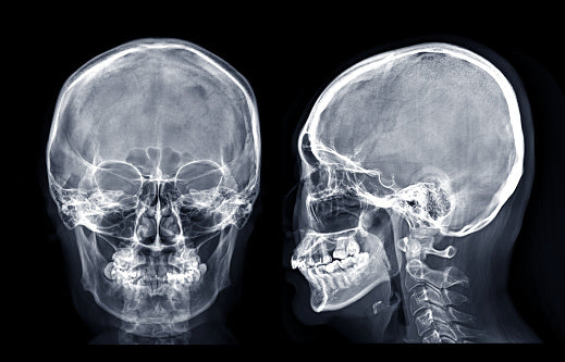 Radiografía de cráneo, 2 posiciones en Hospital San José